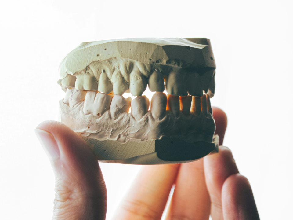 Bad Breath (Halitosis): Causes, Treatments, and Prevention