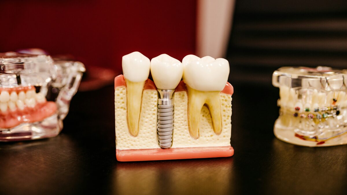 Gum Disease (Gingivitis & Periodontitis): Symptoms, Causes, and Treatment