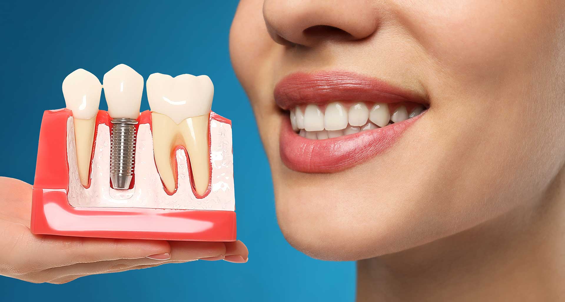 What to Expect During Your Dental Implant Procedure